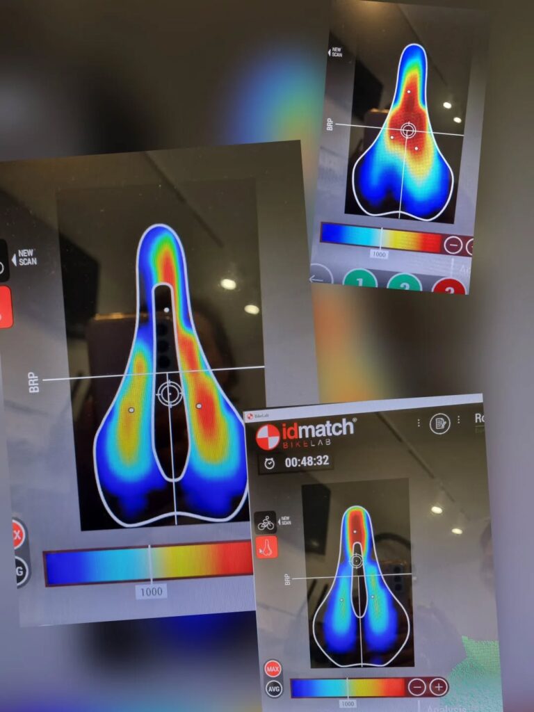 Siddesår og bikefit